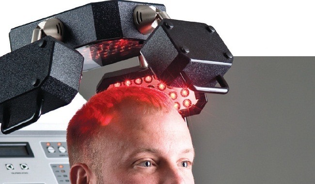 laser hair loss therapy red light therapy for hair loss